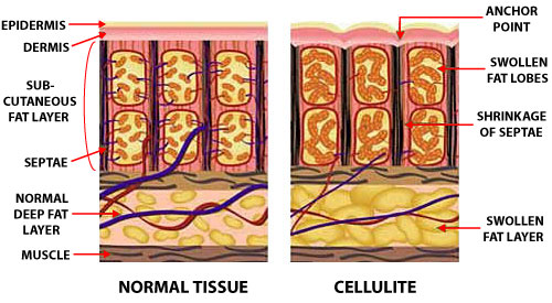 Normal Skin and Cellulite